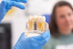 Dental Implant Post-Care Guide