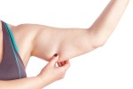 Top 5 Benefits of an Arm Lift for Body Contouring