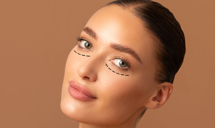 5 Tips For Recovery After Blepharoplasty