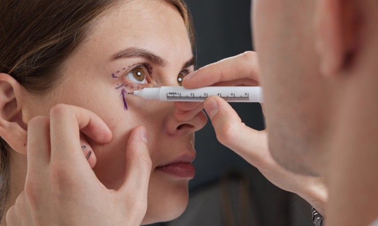 Can Eyelid Surgery Improve Vision?