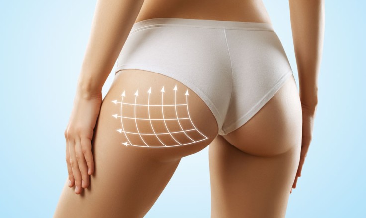 How to Prepare for a Brazilian Butt Lift (BBL) in Turkey?