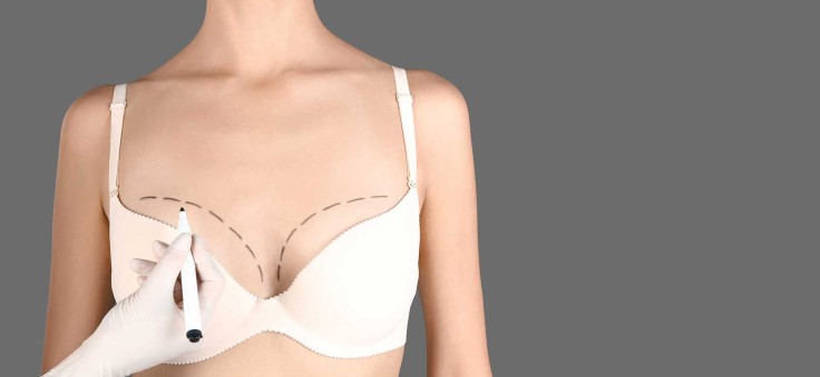 Practical Tips After Breast Augmentation