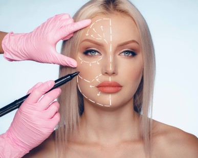 What You Need to Know Before Getting Cosmetic Surgery