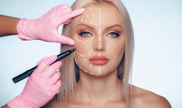 What You Need to Know Before Getting Cosmetic Surgery