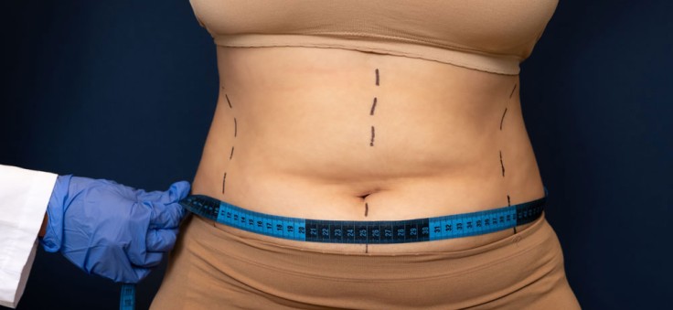 Full Tummy Tuck vs Mini Tummy Tuck: What's The Difference? 