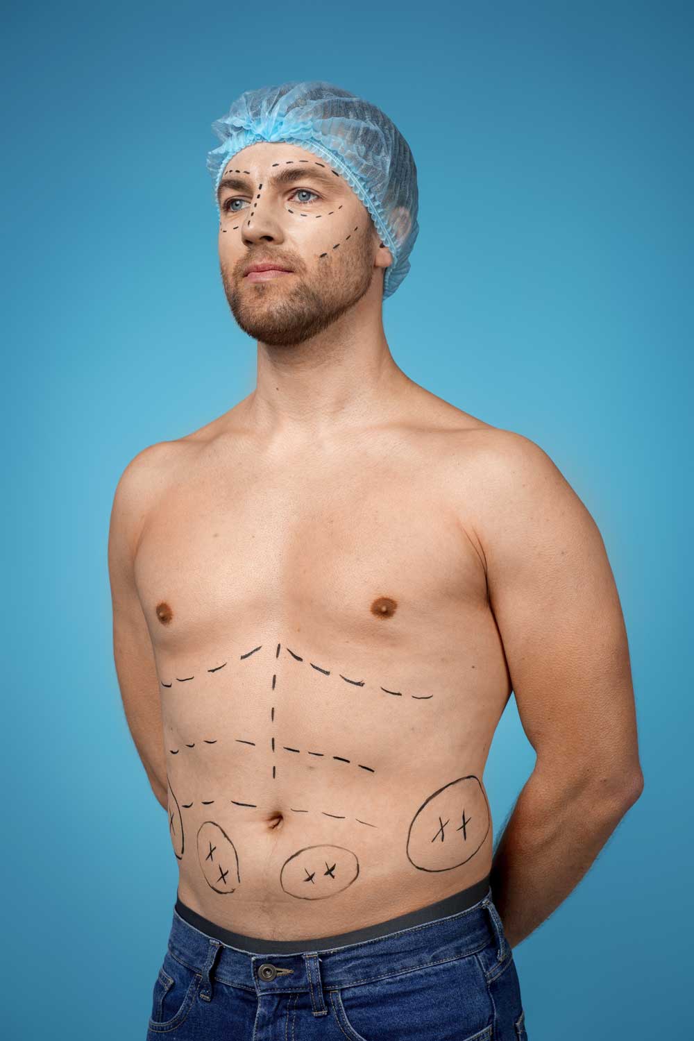  Liposuction for Men