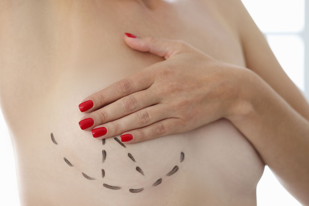 Everything You Need to Know About Mammoplasty