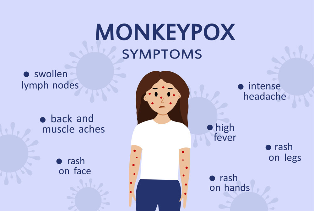 Alles, was Sie über Mpox (Mpox) wissen müssen