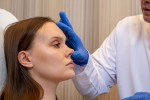 ¿Cómo debe cuidarse la piel después de una rinoplastia?