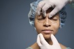 5 Common Myths About Rhinoplasty Surgery Debunked