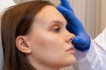 Septoplastia frente a rinoplastia: ¿Cuál es la diferencia?