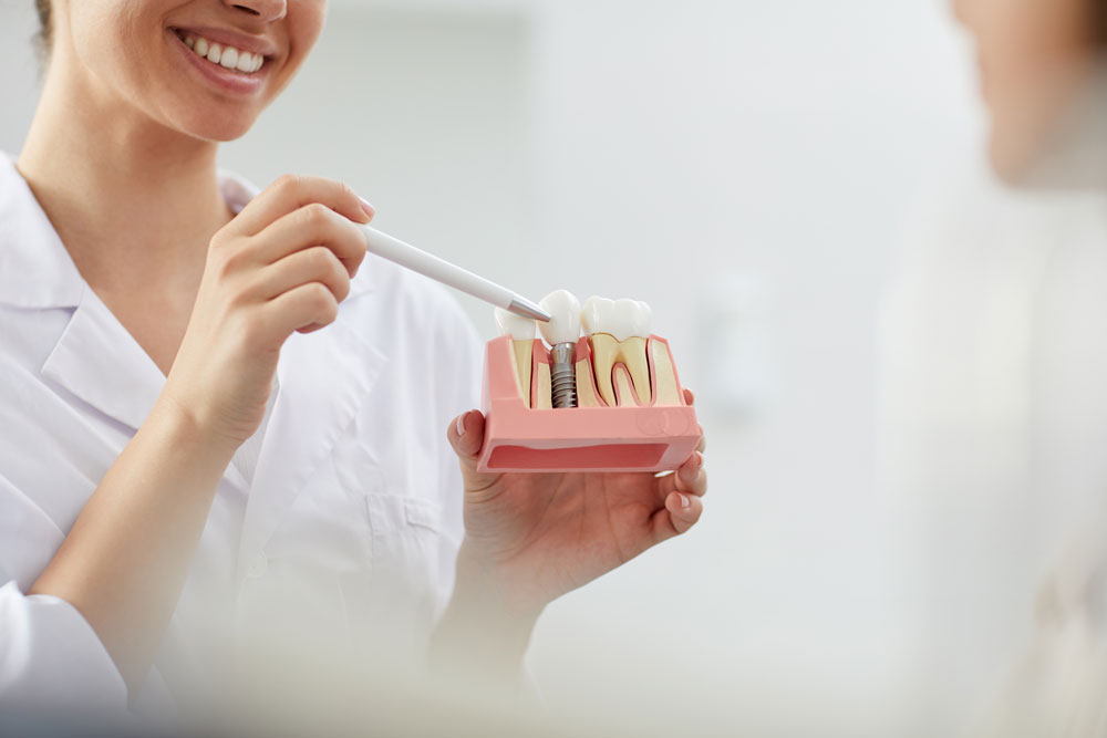 7 Things To Know Before Getting Teeth Implants