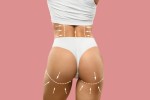 Thigh Liposuction in Turkey: What To Expect, Procedure, Cost