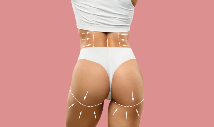 Thigh Liposuction in Turkey: What To Expect, Procedure, Cost