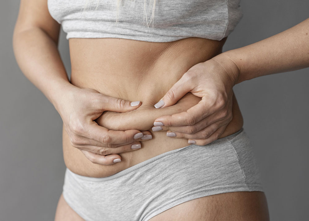 How Soon Can You Exercise After a Tummy Tuck?