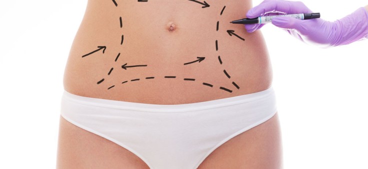 How to Sleep After a Tummy Tuck for Optimal Healing