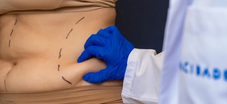 Tummy Tuck Surgery Procedure Steps in Turkey