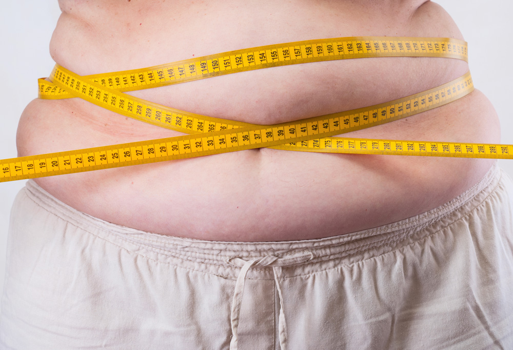 How to Prepare for Weight Loss Surgery: A Complete Guide