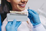 7 Important Tips for Maintaining Veneers