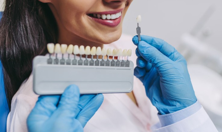 7 Important Tips for Maintaining Veneers